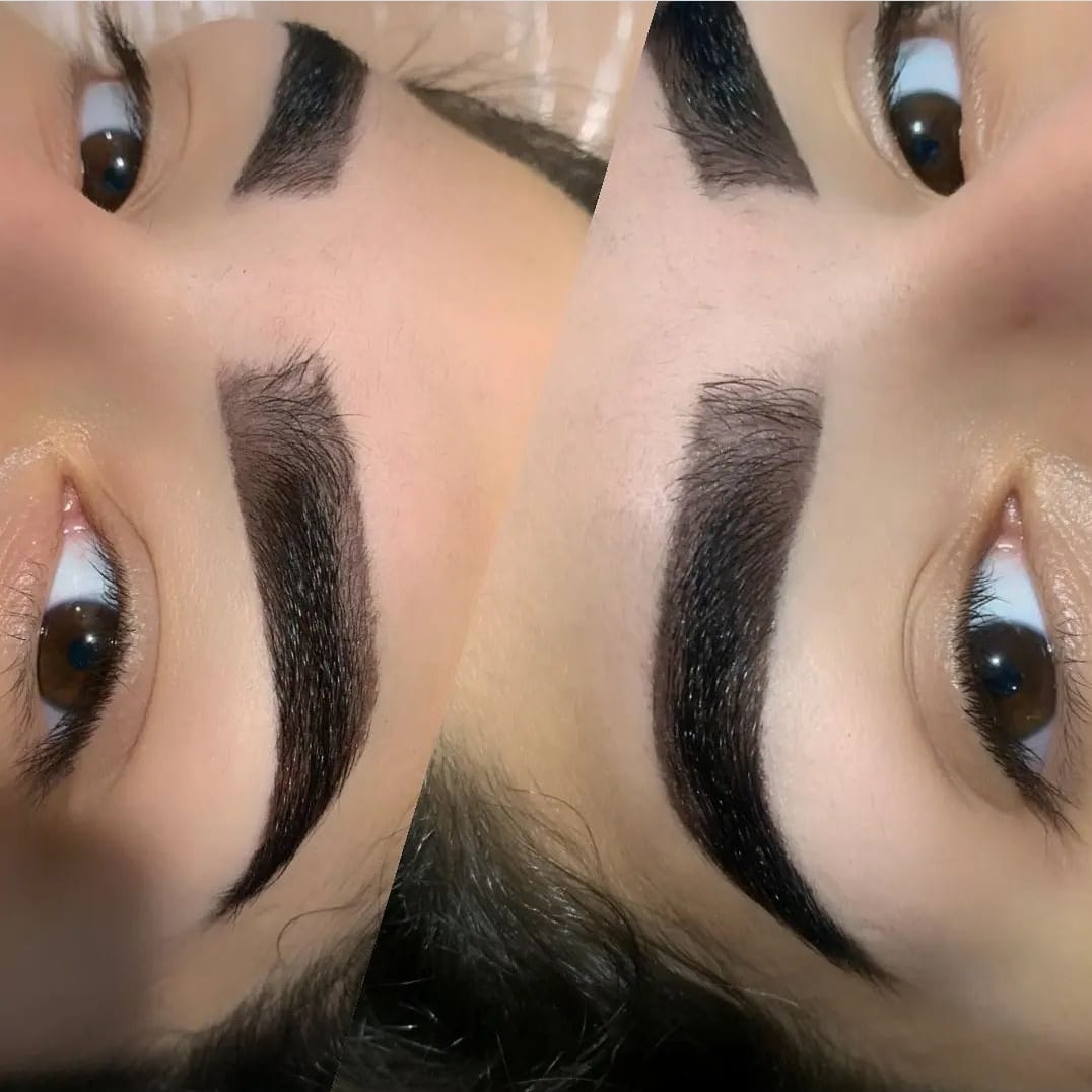 fotos de equipamentos medicos