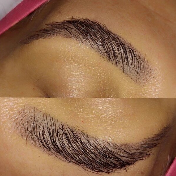 fotos de medicamentos