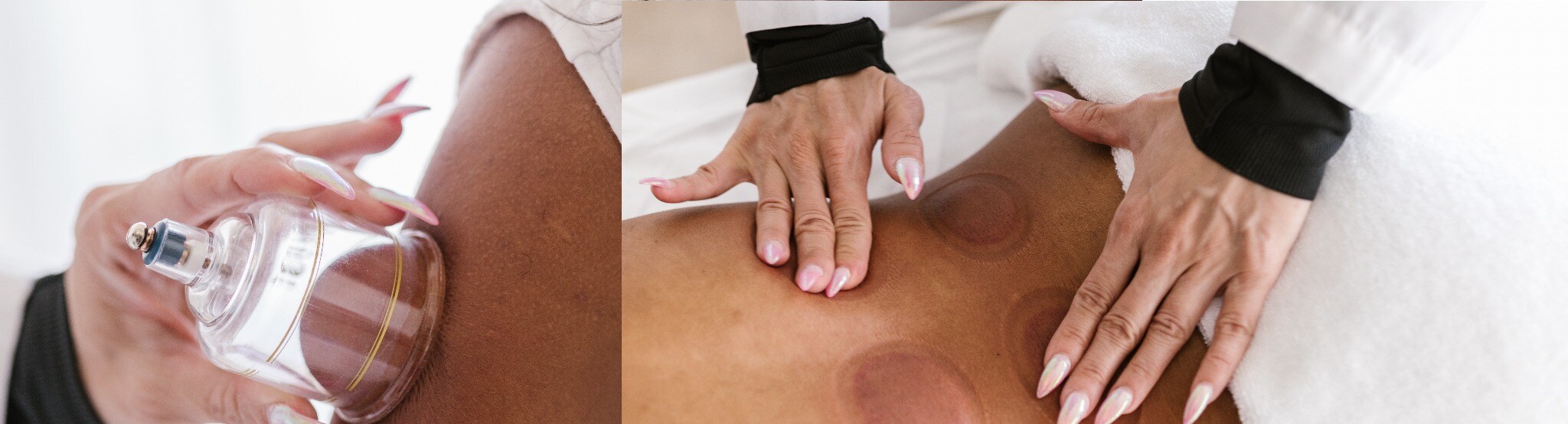 Foto de equipamentos medico